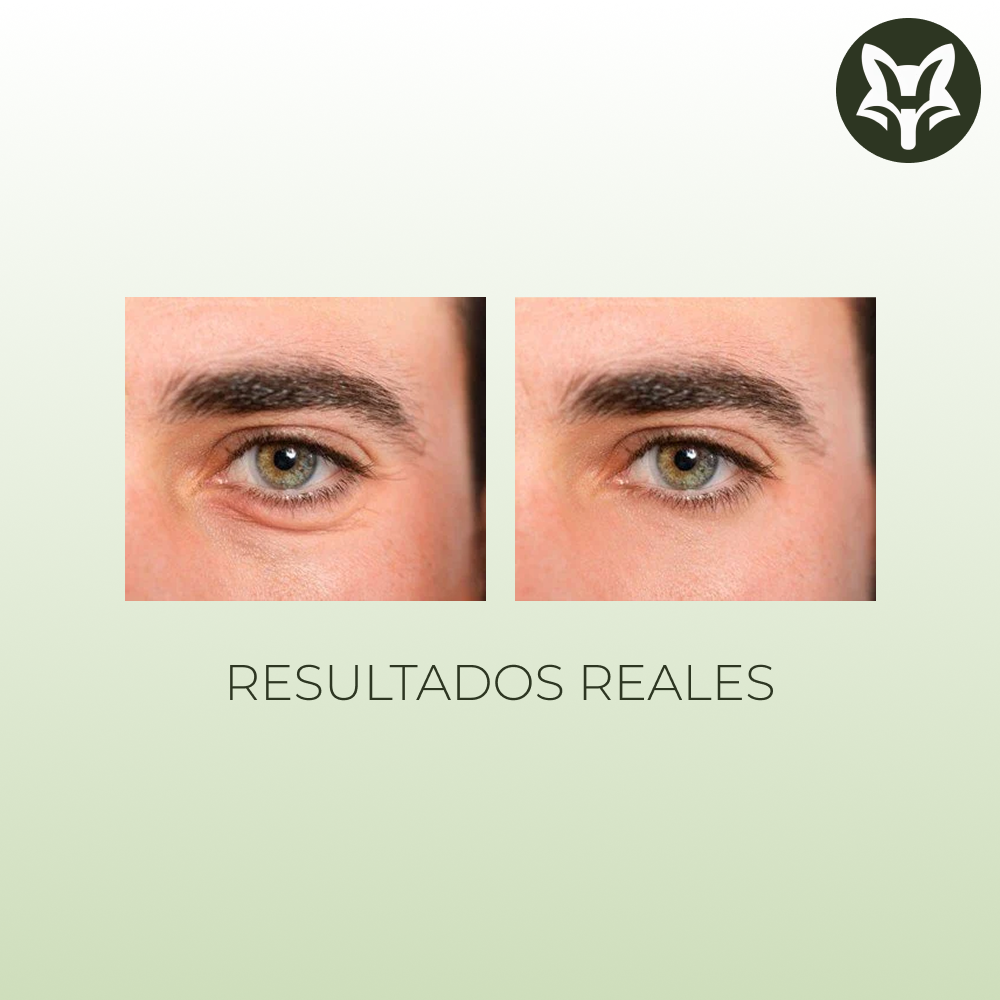 Crema Contorno de Ojos con Retinol y Cafeína – 20 g