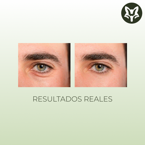 Crema Contorno de Ojos con Retinol y Cafeína – 20 g